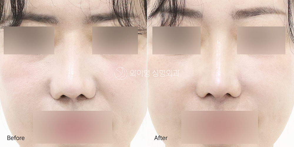 260624_1_front