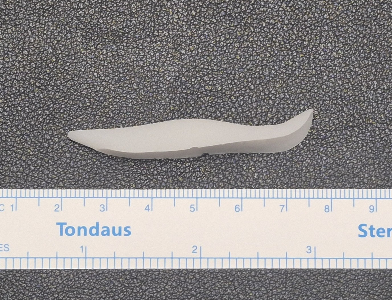 3D-customized silicone implant for subtle dorsal hump augmentation
