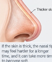 Why Does Skin Thickness Matter in Rhinoplasty?